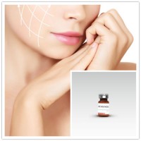 2018 Reyoungel Skin Rejuvenating Serum for Mesotherapy Solution with Hyaluronic Acid 1.5%