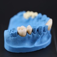 Metal Free Mer Dental Lab All Ceramic Restorations Crown Dental Lab