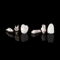 Mer Dental Lab Implant Restorations Zirconia Crown