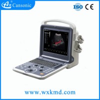High Resolution 4D Ultrasound Scanner with Build-in Battery