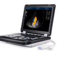 Laptop Pet Clinic Veterinary Color Doppler Ultrasound Scanner 3D  4D Model
