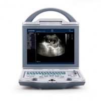 Durable/ Functional/ Affordable B/W Ultrasound Scanner for Human (KX5600)