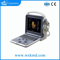 4D Fetal Ultrasound Scanner with Ce