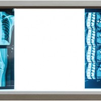 Three Bank LED X-ray Film Viewer