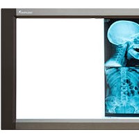 4 Bank X-ray Film Viewer