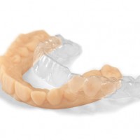 Clear Aligners Dental Orthodontics