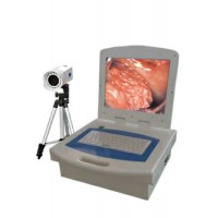 Cheapest Medical Equipment Digital Optical Colposcope