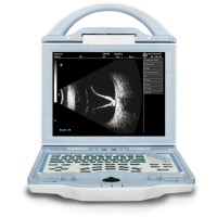 Full-Digital Laptop Ophthalmic Ultrasound Ab Scan Machine