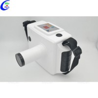 The Cheapest Mobile X Ray Camera for Dental Image