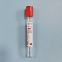 Blood Collection Tubes10ml 12ml 15ml Korea Easy Prp Kit /Prp Tube