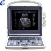 Portable Echocardiography 4D Color Doppler Ultrasound Scanner  Portable Echo Ultrasound Machine for