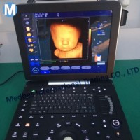 Obstetric and Gynecological 4D Fetal Doppler Ultrasound Scanner 4D Ecocardiograma