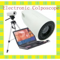 Laptop Digital Video Colposcope Medical Equipment for Gynecology