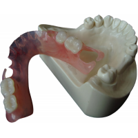Flexible Denture china dental lab